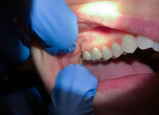 Best Emergency Dentist for Kids  in Friday Harbor, WA