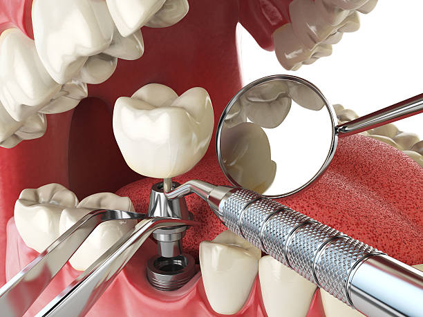 Best Urgent Tooth Repair  in Friday Harbor, WA