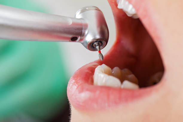 Best Emergency Dental Services Near Me  in Friday Harbor, WA